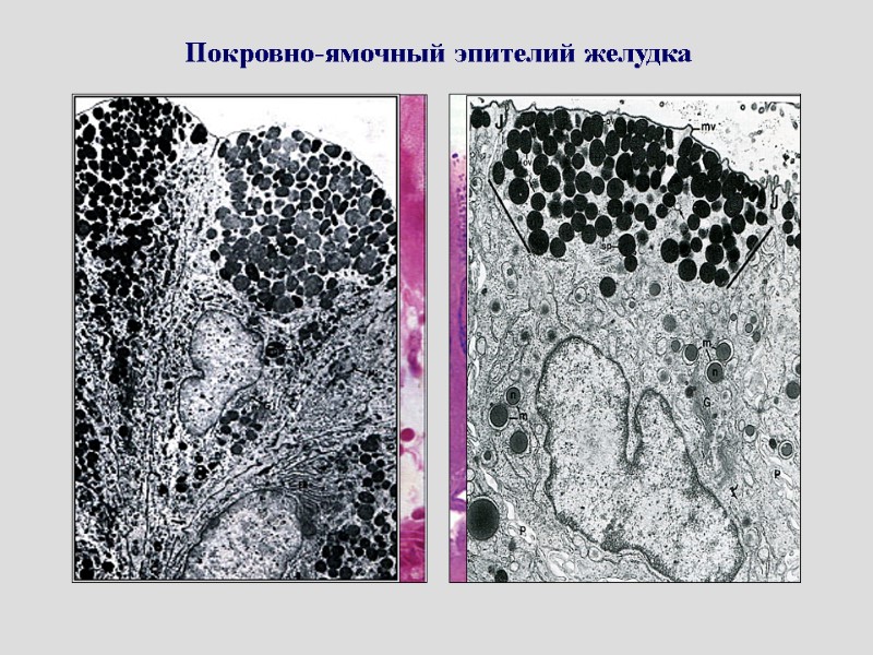 Покровно-ямочный эпителий желудка